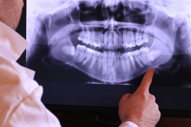 Best Emergency Dental Services for Seniors in Elsa, TX
